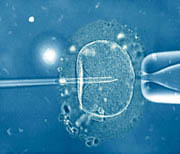 IVF treatment